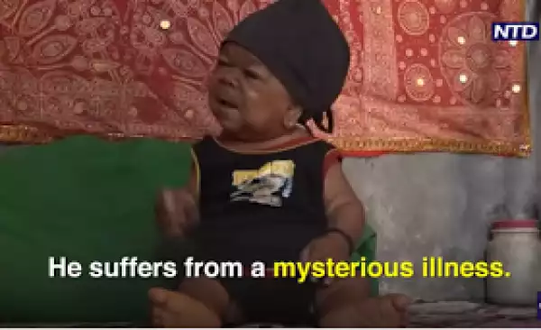 Meet The 22-Year-Old Indian Man Trapped In The Body Of A Baby. Photos
